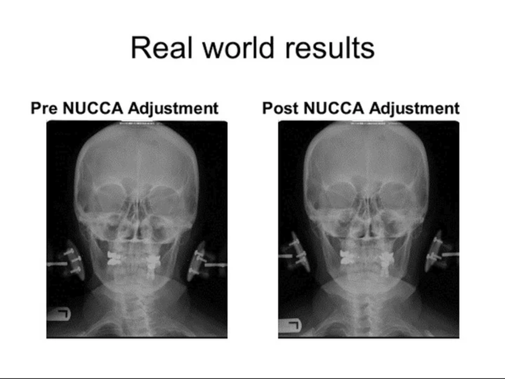 Houston NUCCA Doctor Results