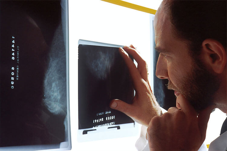x-ray